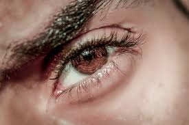 Nose symptoms, also called nasal symptoms, include any symptoms that affect the nose. Your Dark Undereye Circles May Be Caused By Nasal Allergies Dr Gan Eng Cern