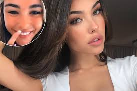 We will be discussing many plastic surgeries in this … madison beer and nicola peltz: Madison Beer Clapped Back At Tiktok User Katie Kelly About Plastic Surgery Rumours Girlfriend