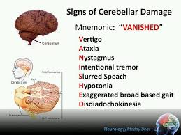 There Are Several Mnemonics On Memorizing Signs Of Cerebellar Damage Here S One Out Of The Nursing Mnemonics Neurology Nurse Practitioner School