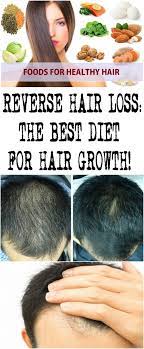 Reverse Hair Loss The Best Diet For Hair Growth Reverse Hair Loss Hair Loss Cream Hair Loss Remedies