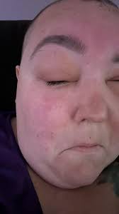 Surviving a Medical Operation: A Personal Journey