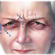 International Textbook of Aesthetic Surgery