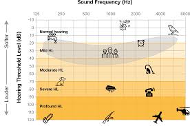 Image result for Audiogram