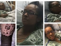 Fundraiser by Magalie LaMothe : My Sisters Medical Battle w/Lupus