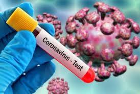 COVID-19 test begins in Surkhet