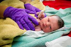 Prader Willi Syndrome Diagnosis Care In Infants Needs Improvement French Study Suggests