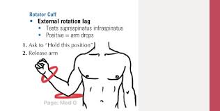 Image result for Drop Arm Test