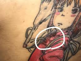 Is My Tattoo Healing Normally Or I Got My Tattoo Done Around 6 Days Ago Probably