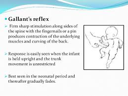 Reflexes Present In Infants