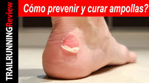 Como Prevenir Y Curar Las Ampollas En Tus Pies En El Trail Running Youtube