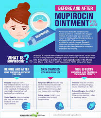 Image result for Mupirocin