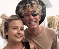 My Kitchen Rules: Why does Ash wears an eye patch?