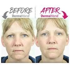 DermaWand PRO Newest Model
