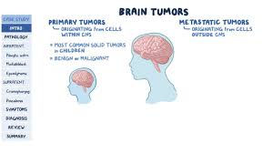 If you think you may have a tumor, talk to your. Pediatric Brain Tumors Pathology Review Osmosis