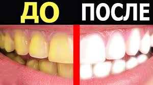7 Super Sposobov Otbelit Zuby Youtube