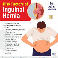 Image result for Inguinal hernia man