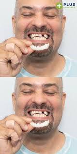 Randy Fulbright (ipfd)