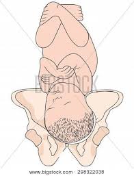 When the occiput is facing the maternal pubic symphysis, the position is termed direct occiput anterior. Left Occiput Vector Photo Free Trial Bigstock