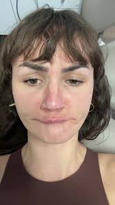 Understanding Misconceptions About Dental Implants