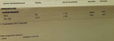 We did not find results for: Informed Consent Dan Diagnosa Kanker Jayanti Kumparan Com
