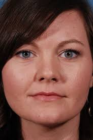 Dallas Rhinoplasty Center in Dallas-Fort Worth TX