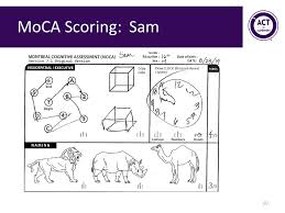 The montreal cognitive assessment (moca) is a brief cognitive screening test with high sensitivity and specificity for detecting mild neurocognitive disorder / mild cognitive impairment (mci).the moca is particularly useful for detecting cognitive changes in those with higher levels of education, or where mild cognitive changes are the primary clinical concern. An A Z Guide For Working With Patients With Memory Loss And Dementia Ppt Download