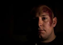 11 Black Eye Campaign Sabers Conduct Social Experiment Image: PICRYL