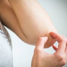 Epsom salt baths during pregnancy are also essential when it comes to dealing with the recurrent candida. Can Epsom Salts Help Eczema Symptoms Woman Claims It Cured Hers Allure