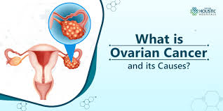 That said, deaths from ovarian cancer have been falling in the u.s. A Detailed Analysis On Ovarian Cancer Its Causes And Symptoms