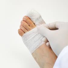 To find out more complete and clear information or images, you can visit the. Ibu Jari Putus Jempol Kaki Pria Ini Dipindah Ke Tangan Health Liputan6 Com