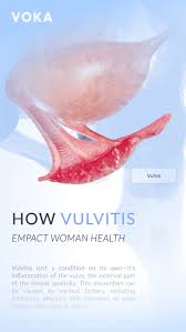 Image result for Vulvitis