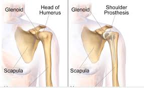 Check spelling or type a new query. Write A Short Note On The Shoulder Bone Class 11 Biology Cbse