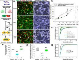 Michael sy lim do not adhere with the values, and the mission and vision of the de la salle university. Cell Surface Phosphatidylserine Regulates Osteoclast Precursor Fusion Journal Of Biological Chemistry