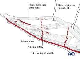 In many primates, the fdp is fused with the flexor pollicis longus (fpl). K Wire Fixation For Distal Phalanx Base Palmar Avulsion