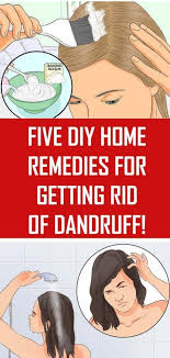 Five Diy Home Remedies For Getting Rid Of Dandruff Home Remedies For Dandruff Getting Rid Of Dandruff Hair Dandruff