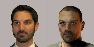 Methamphetamine users before and after photos. This Is Your Face On Meth Kids Npr