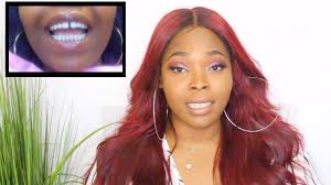 The gap in the front teeth is called diastema in dental terminology. How To Close Gap Teeth Without Braces In 45 Mins My Dental Bonding Experience Youtube