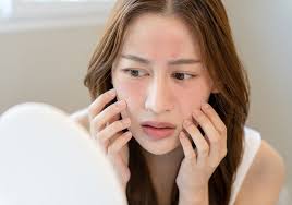 Vì sao da mặt bị đỏ | Nguyên nhân và cách phục hồi – Dr. Baumann VN