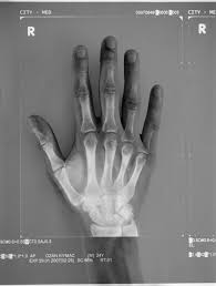 Cool Poster Graphic Poster Medical Illustration X Ray