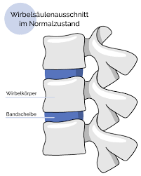 Osteochondrose Symptome Therapie Ratgeber Nerven