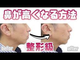 ボード 小顔 施術 美容 マッサージ 矯正 のピン