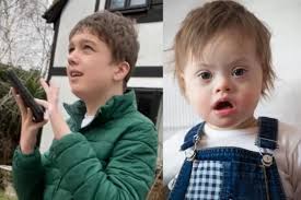 Inilah Perbedaan Down Syndrome Dan Autis Yang Sering Dianggap Sama