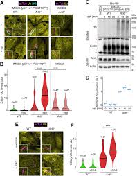 With marlins job, kim ng is 'bearing a torch for so many'. Lysine63 Linked Ubiquitin Chains Earmark Gpcrs For Bbsome Mediated Removal From Cilia Biorxiv