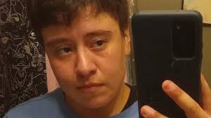 Fundraiser by Alba Lopez : Support Arturo's Top Surgery Recovery