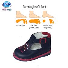 Best kitchen shoes for high arches. Best Walking Child Kids Shoes For Flat Feet And High Arch Price Factory Turkey View Flat Foot Falcon Product Details From Etkin Medikal Ve Reklam Dis Ticaret Limited Sirketi On Alibaba Com