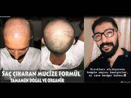 Lokman Hekimin Sac Cikarma Formulu