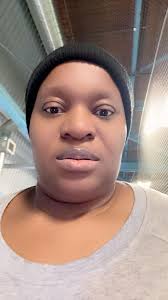 I like that I'm losing weight with my sleeve but the one thing that is  killing my self esteem is my surgery scars. Any advice