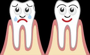 Lindungi gigi cintai gigi hari gigi kartun gambar unduh gratis. Gigi Pembusukan Sehat Gambar Vektor Gratis Di Pixabay