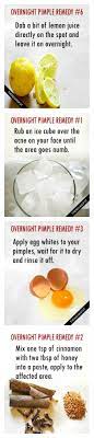 Use this mixture on spots and leave it overnight. Natural Ways To Get Rid Of Pimples Overnight