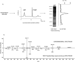 .dionex detectors dionex ion chromatography systems dionex pumps dionex systems hitachi hplc hp / agilent hplc hp dionex ad25 absorbance detector. Detection And Characterization Of Selenoproteins By Tandem Mass Spectrometry Assisted By Laser Ablation Inductively Coupled Plasma Mass Spectrometry Application To Human Plasma Selenoproteins Journal Of Analytical Atomic Spectrometry Rsc Publishing